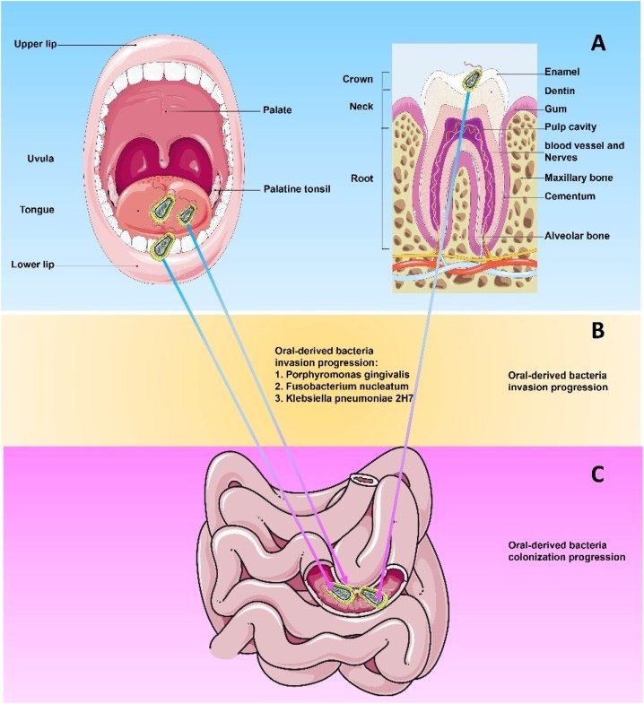 Oral Health Body Connection